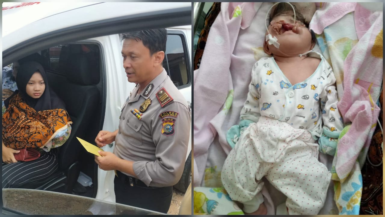 Luar Biasa, Kapolsek Tambusai Bantu Biaya Pengobatan Bayi Siti Asmira di Rujuk di RSUD Rohul