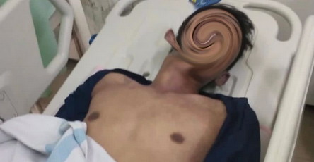 Tiga Nyawa Melayang Usai Masuk Hiburan Malam Satu Orang Kabarnya Oknum Polisi