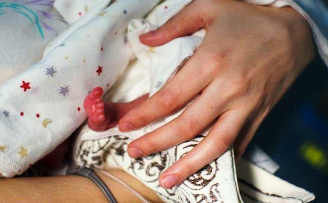 Anak Penderita Penyakit Cornelia De Lange Syndrome Miskin