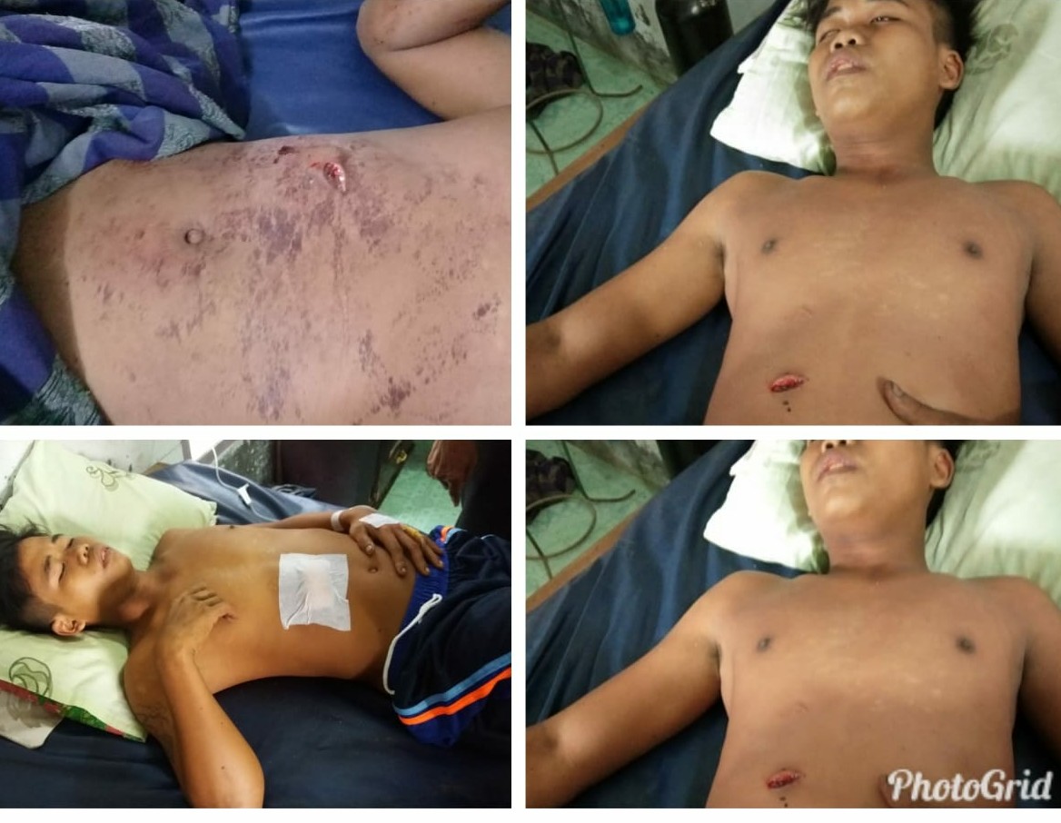 Gara Gara Tersinggung, Nekat Tikam Temannya Sendiri Hingga Tewas