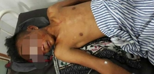 Terduga Maling di Kubang Raya Nyaris Tewas Dimassa
