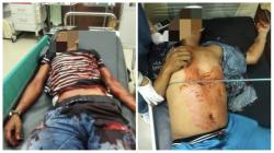 Anggota Polisi dan Warga di Rohil Tewas Usai Ditikam Sekuriti, 1 Selamat