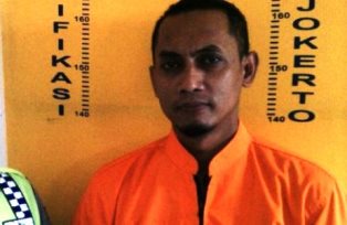 Wajah Dian Wulansari Melepuh Disiram Pacar Karena Cemburu