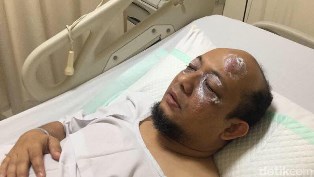 Kami Tidak Akan Berhenti Melawan Korupsi